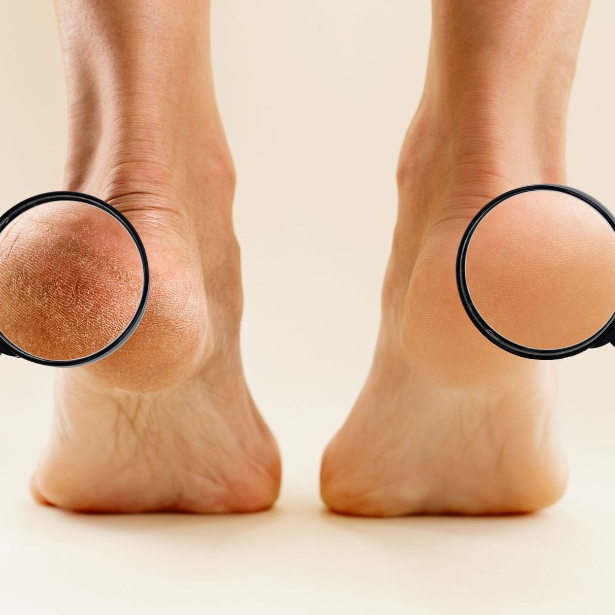 Peaufinage des pieds - SOINS DEUX PIEDS